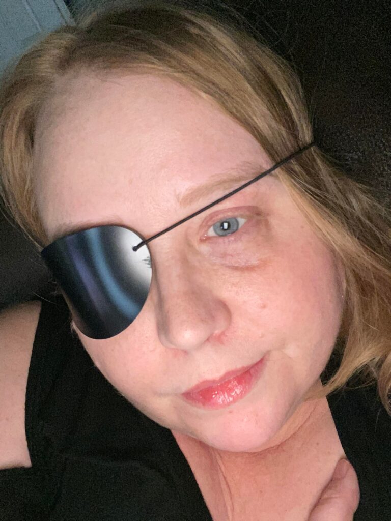 Alison Sonju with an eye patch